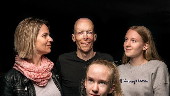 Sébastien Maillard, brûlé à 92% en 2000, avec son épouse Karine et leurs deux filles