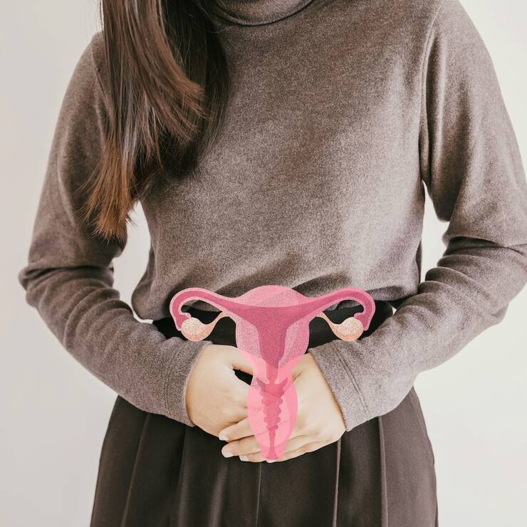 Le syndrome des ovaires polykystiques (SOPK)