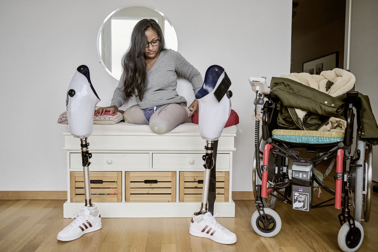 Neeta Gervasi et ses prothèses de jambe