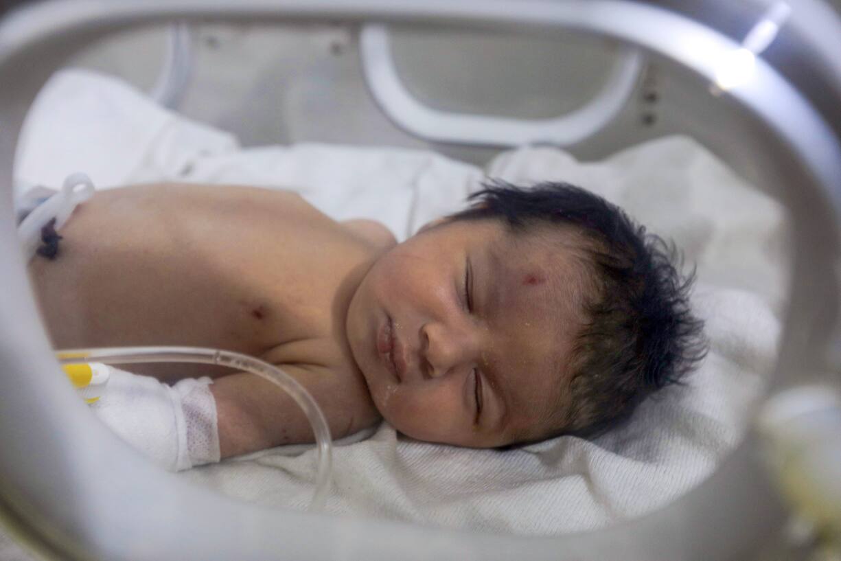 La petite fille a immédiatement été amenée à l'hôpital