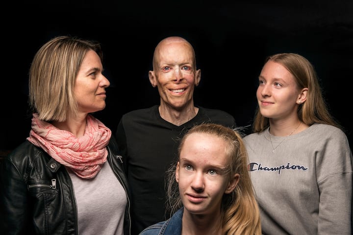 Sébastien Maillard, brûlé à 92% en 2000, avec son épouse Karine et leurs deux filles